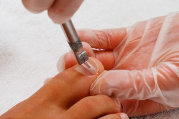 Пластика ногтевых валиков в Минске