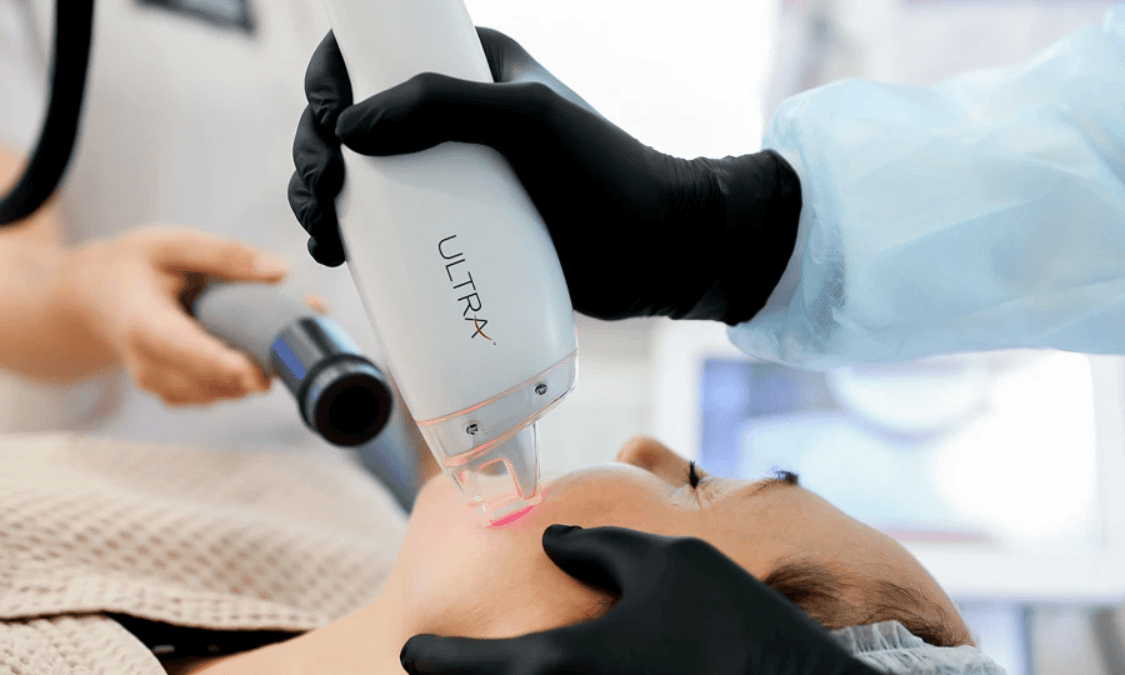 омоложение кожи Lutronic LaseMD Ultra